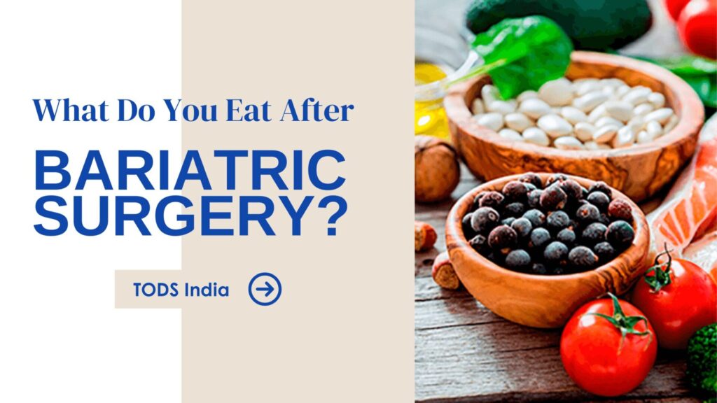 What Do You Eat After Bariatric Surgery?