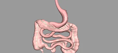 Sleeve Gastrectomy in Bangalore