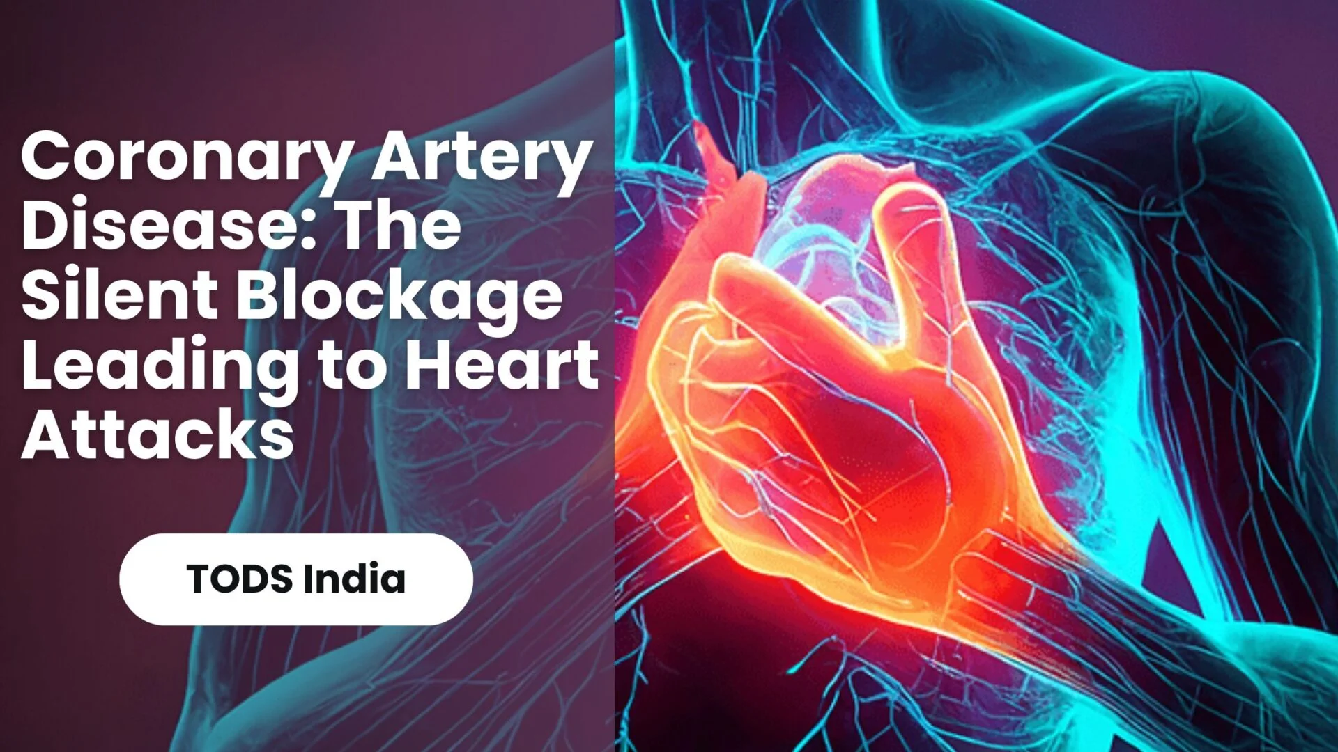 Coronary Artery Disease