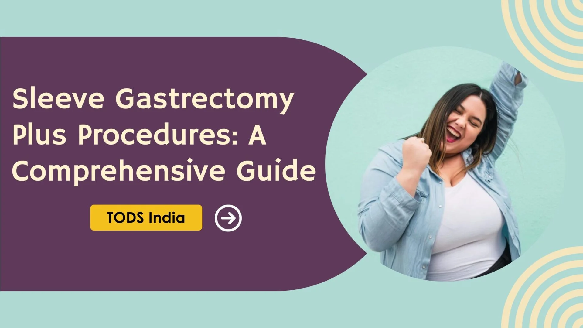 Sleeve Gastrectomy