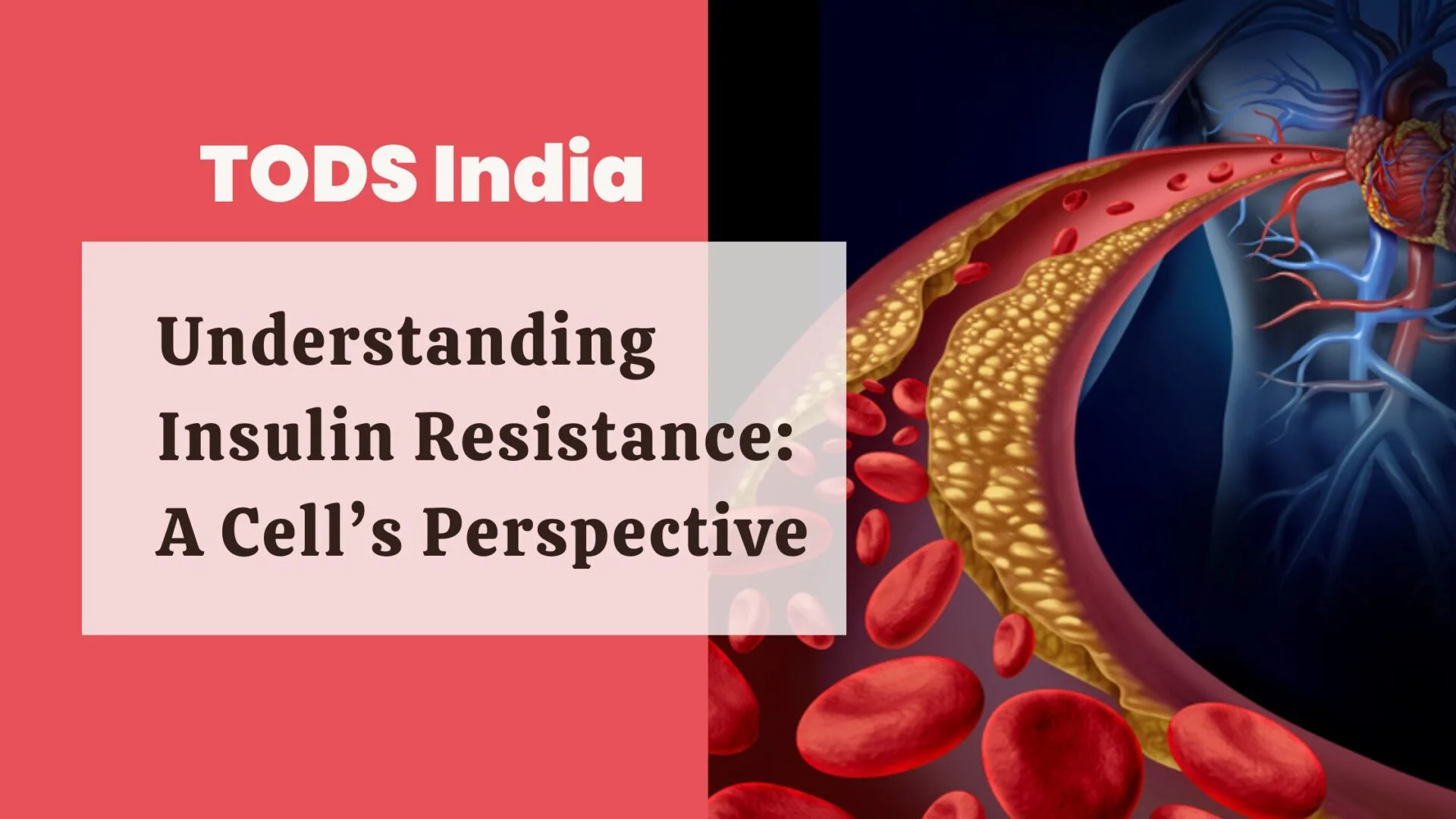 Insulin Resistance