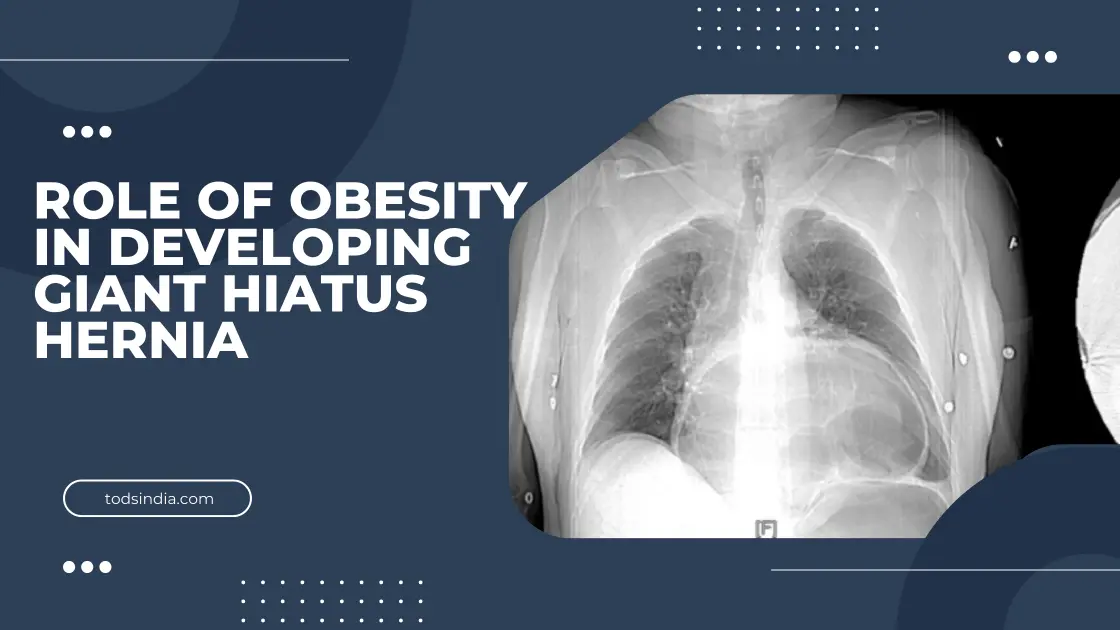 Giant Hiatus Hernia